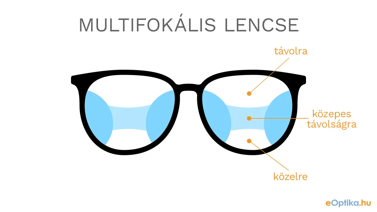 Multifokális lencsél